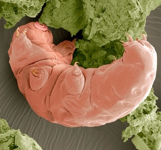 クマムシの電子顕微鏡画像