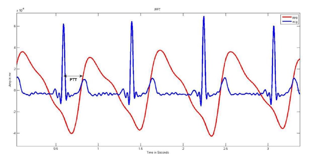 青い線は心電図の曲線、赤い線はPPGによる測定曲線