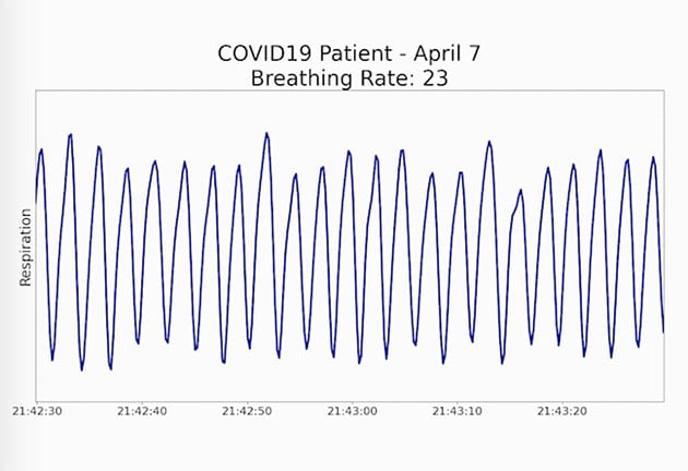 新型コロナ患者の呼吸波形