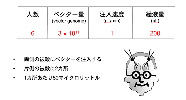 ４カ所にわずか50マイクロリットルずつのAAVベクターを注入するだけ