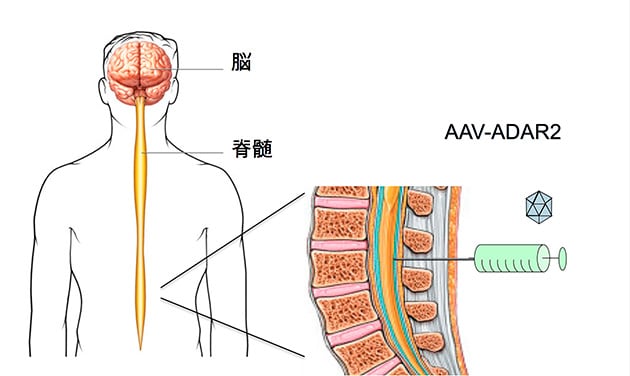 脊髄からAAVベクターを注入してALSを克服