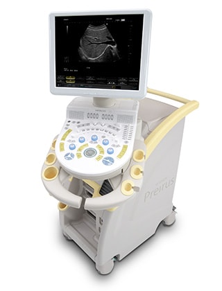 日立メディコの汎用超音波画像診断装置「デジタル超音波診断装置　HI VISION Preirus」の写真