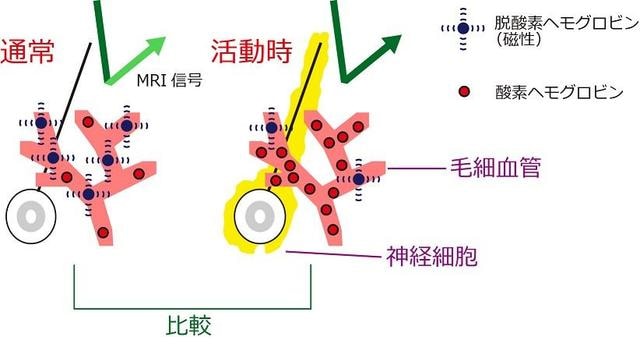 脳の活動を検知する原理