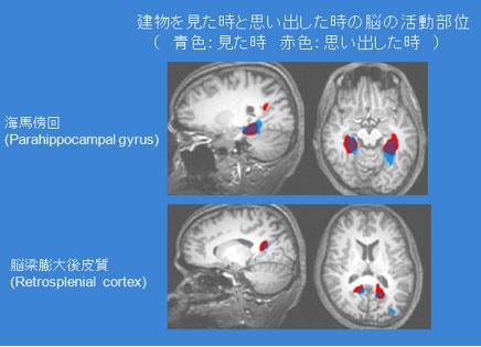 fMRIでの試験結果例