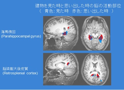 fMRIでの試験結果例